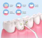 Powerful Ultrasound Water Flosser